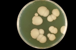 1024px-Candida_albicans_PHIL_3192_lores
